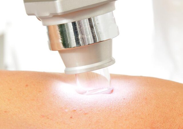 hautarzt-dr-thomas-hautkrebsvorsorge