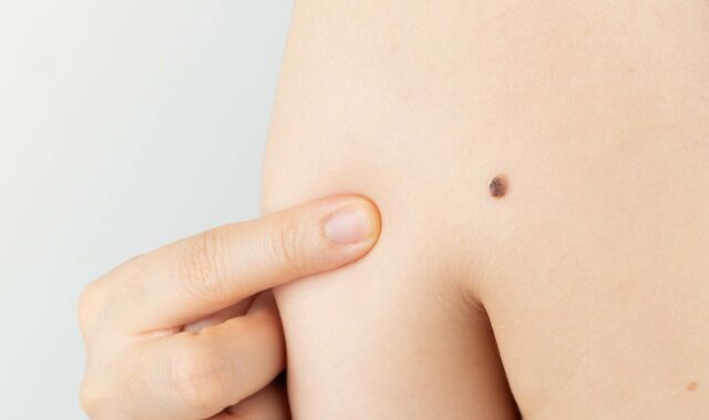 hautarzt-dr-thomas-dermatologie-header