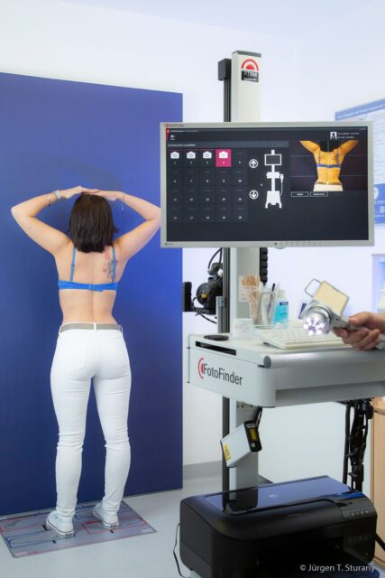 Früherkennung von Hautkrebs Prävention von Dr. Thomas